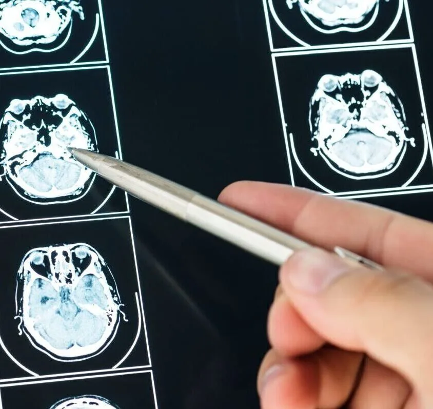 Closeup - Brain Injury